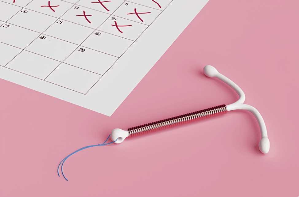 Bingung Pilih IUD atau IUS?